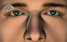 content lacrimal 2 Lacrimal Procedures