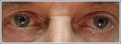 cosmetic 1 Cosmetic Procedures