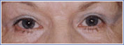 cosmetic 2 Cosmetic Procedures