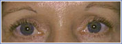 cosmetic 3 Cosmetic Procedures